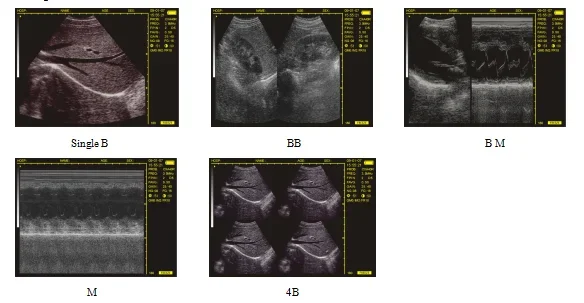 Sistema portátil médico do diagnóstico do ultrassom do varredor do ultrassom