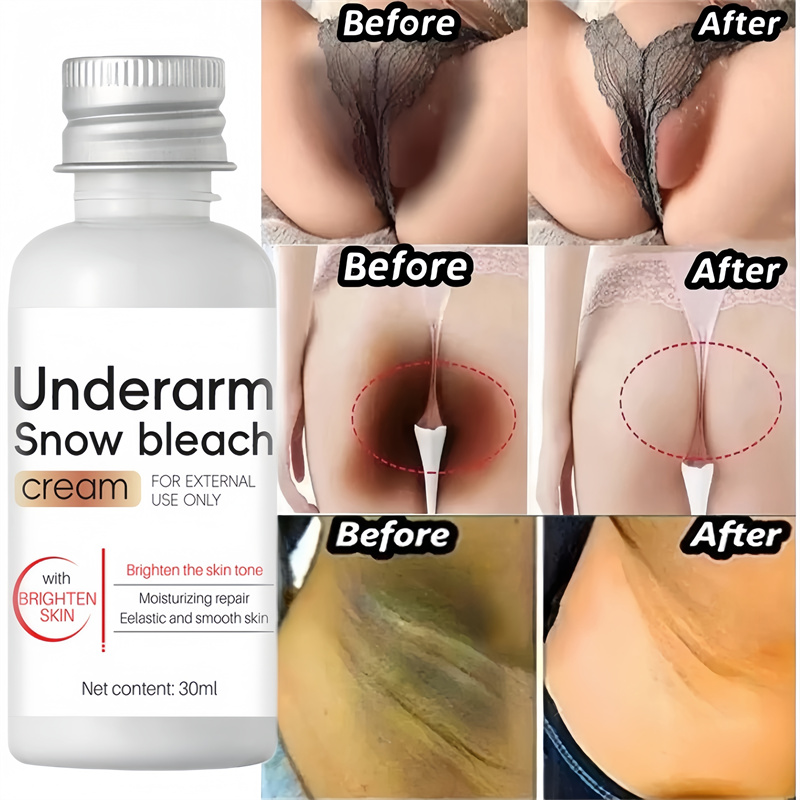 Crema blanqueadora para partes privadas, suero blanqueador para axilas, blanqueador a tope, rodilla, ilumina la parte interior del muslo, partes íntimas, elimina la melanina