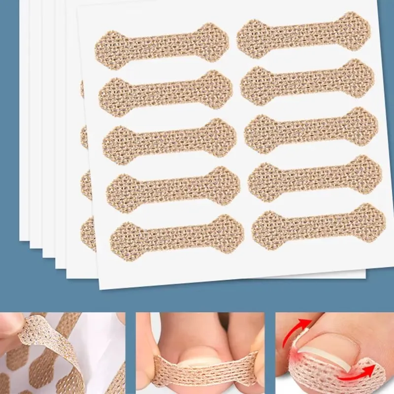 10 Stück Eingewachsene Paronychie Zehennagel-Korrekturstreifen Anti-Nagel-Patch Füße Schlafen Nagel-Patch Nägel in das Fleisch Lange Zehenpolster