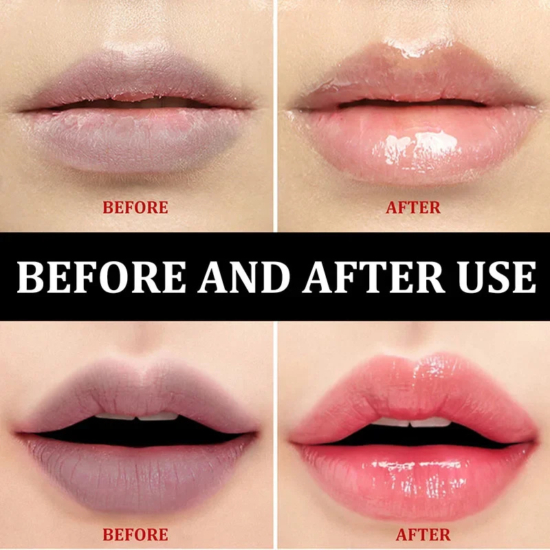 Blanqueamiento de labios rosa de aclaramiento rápido para labios oscuros, bálsamo labial de melanina, aceite de labios mágico rosa Sexy, maquillaje hidratante blanqueador