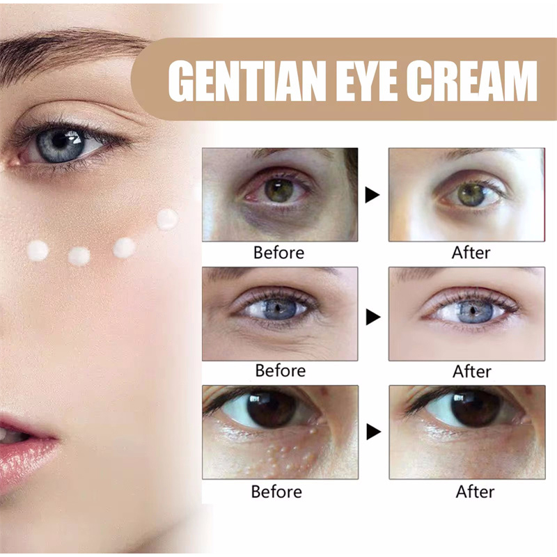 Seúl 1988, 100ml, suero retinal, esencia para el rostro de Ginseng, comedones cerrados, brillo, hidratación Facial, esencia de cuidado coreana