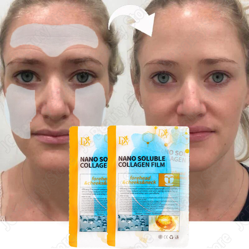 Removedor instantâneo de rugas, proteína de colágeno, conjunto de soro, levantamento, endurecimento, solúvel, absorvente, enchimento facial, anti-envelhecimento, cuidados com a pele