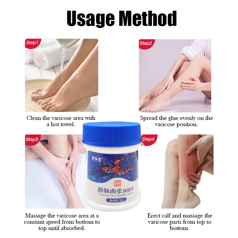 Giãn Tĩnh Mạch Kem Điều Trị Viêm Mạch Phlebitis Nhện Giảm Đau Tinh Dầu Varicosity Angiitis Loại Bỏ 100% Nguyên Bản Thảo Dược