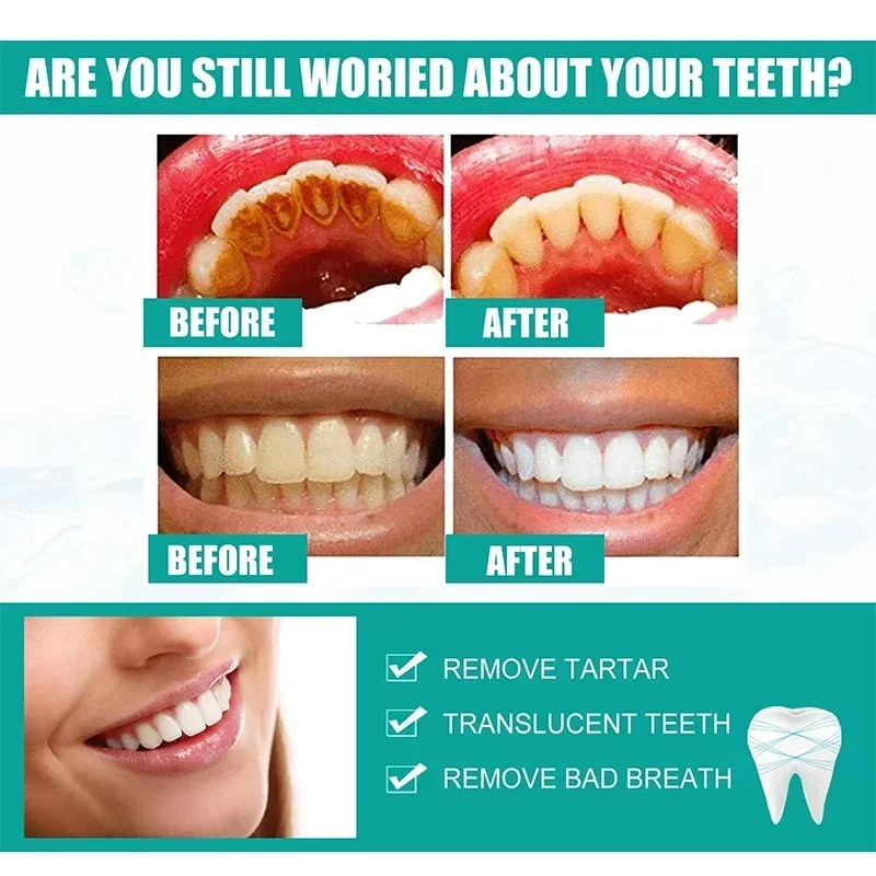 Средство для удаления зубного камня, отбеливающий спрей для зубов, чистка зубной пасты, гигиена полости рта, удаление неприятного запаха изо рта, пятен налета, уход за свежим дыханием