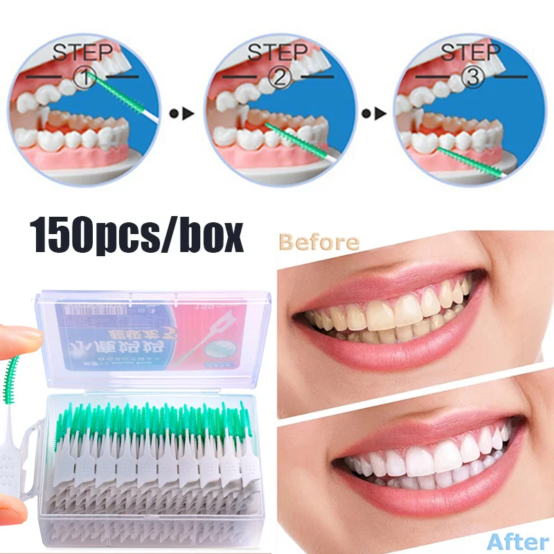 20/150 Chiếc Bàn Chải Kẽ Răng Cao Su Mềm Răng Vệ Sinh Dụng Cụ Nha Khoa Vệ Sinh Giữa Răng Bàn Chải Đánh Răng Vệ Sinh Răng Miệng Dụng Cụ Chăm Sóc