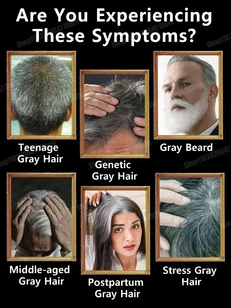 Soro de essência capilar anti-cinza natural e saudável de cabelo branco a preto