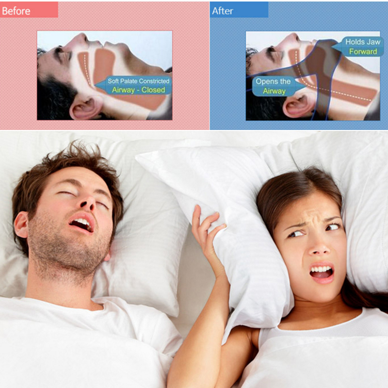 1Pc Cpap Anti Snurk Kin Band Stop Snurken Snurk Riem Slaapmiddel Gereedschap Verstelbare Slaap Apneu Kin Ondersteuning Bandjes Gezondheidszorg