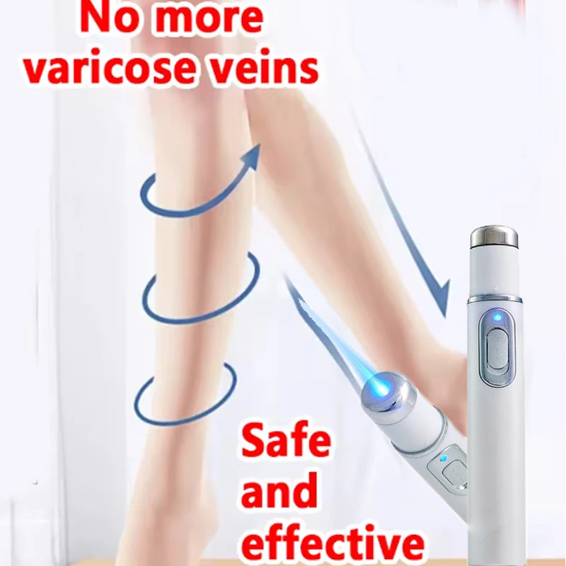 Laser Vein