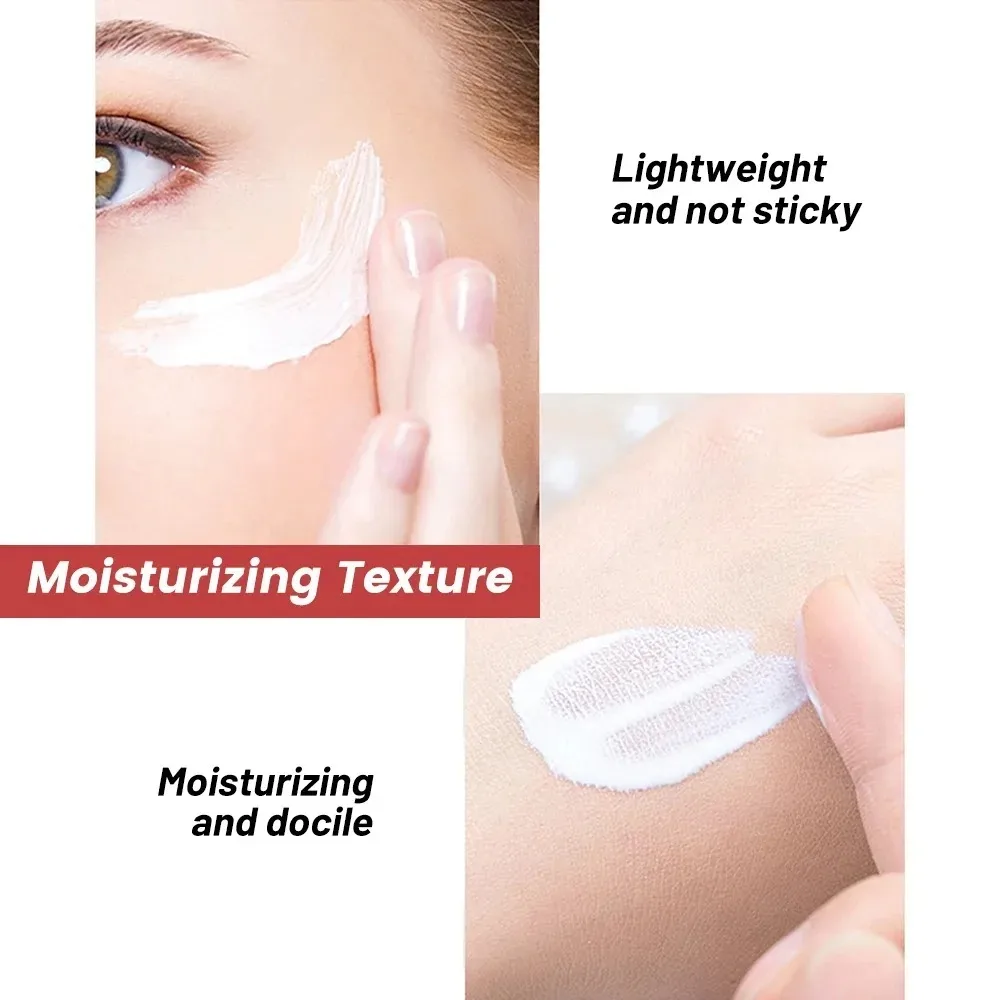 1/3/5pcs Whitening Freckle ครีม Niacinamide ลบ Dark Spot Cream Anti Freckle และ Aging ครีม Fade สีฝ้าผิว