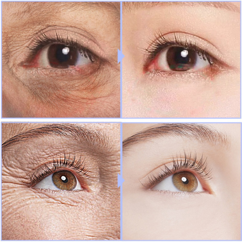 Crema para ojos con Retinol, elimina las ojeras, bolsas para los ojos, hinchazón, reduce las arrugas, suero para los ojos, eliminación de ojeras, cuidado de los ojos para hombre y mujer