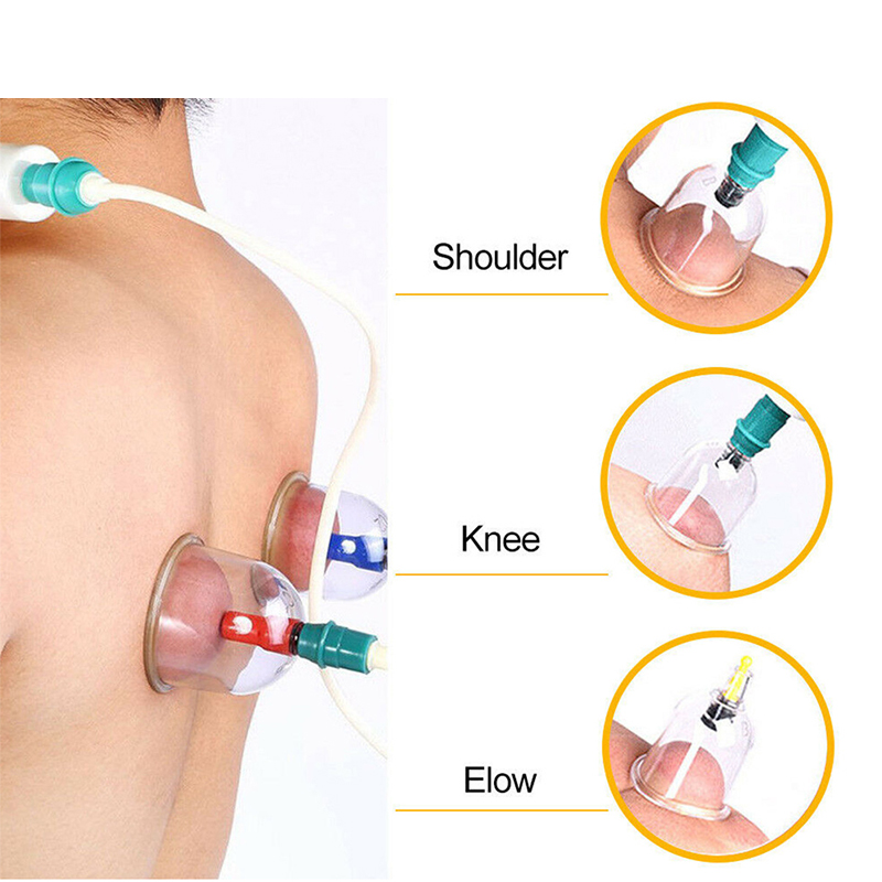1pcs Cupping ชุด Professional จีน Acupoint Cupping Therapy ชุดดูด Hijama Cupping ชุดสูญญากาศแม่เหล็กปั๊ม