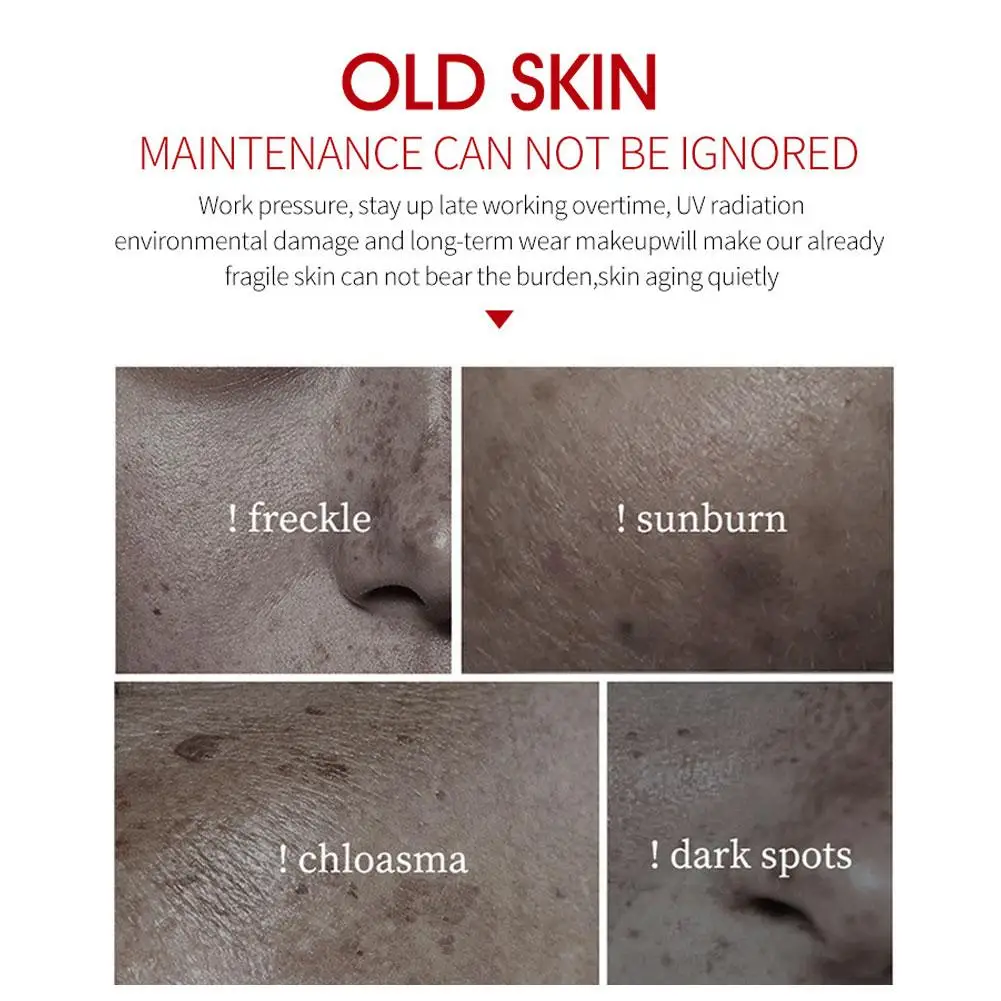 Creme Facial Whiten para Remoção de Sardas, Refirmante e Hidratante, Anti-rugas, Removedor Spot, Soro Facial, Beleza Cuidados com a pele