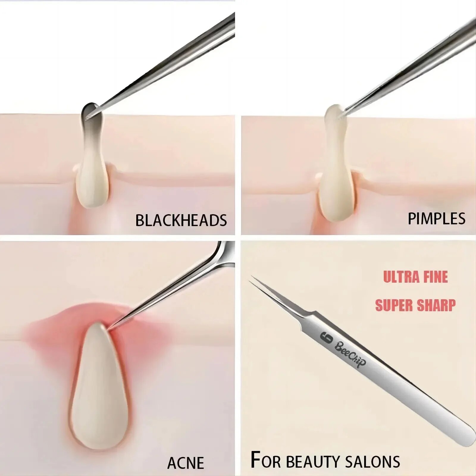 3 unidades de Herramientas de limpieza de poros faciales, pinzas de aguja ultra finas, pinzas de cabeza negra para el acné