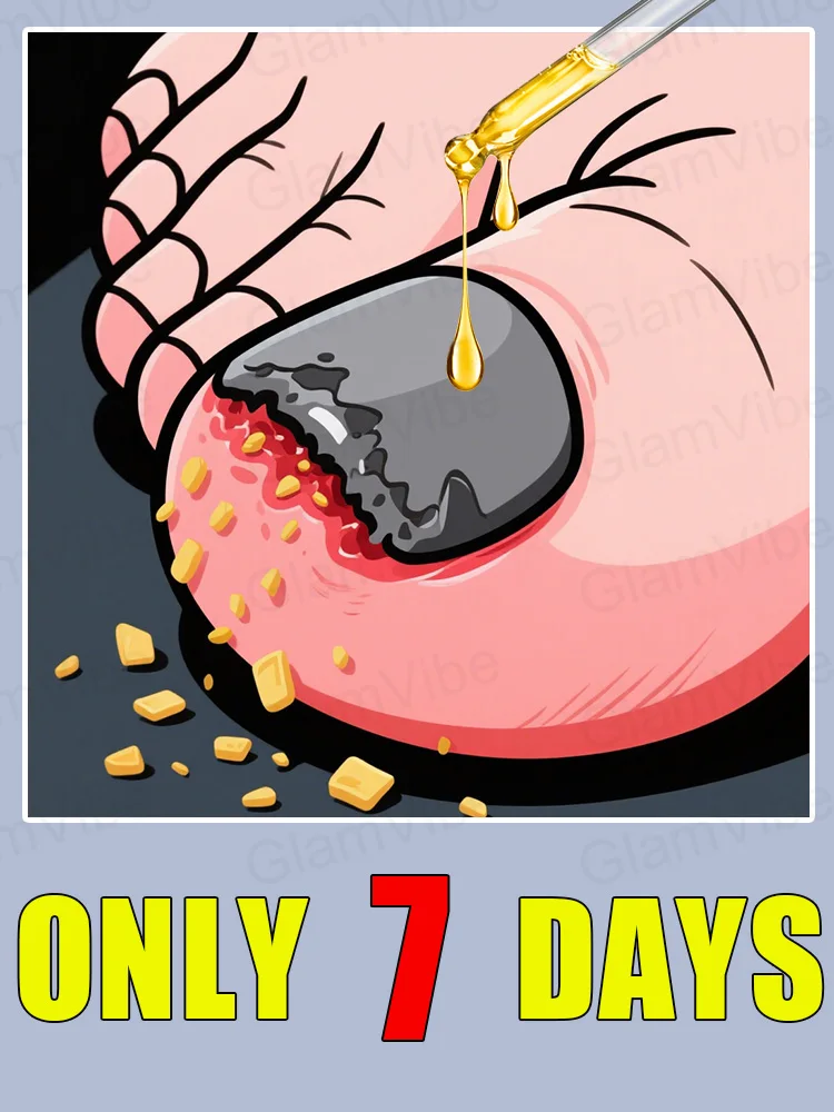 Quickly eliminate fungus and restore healthy nails