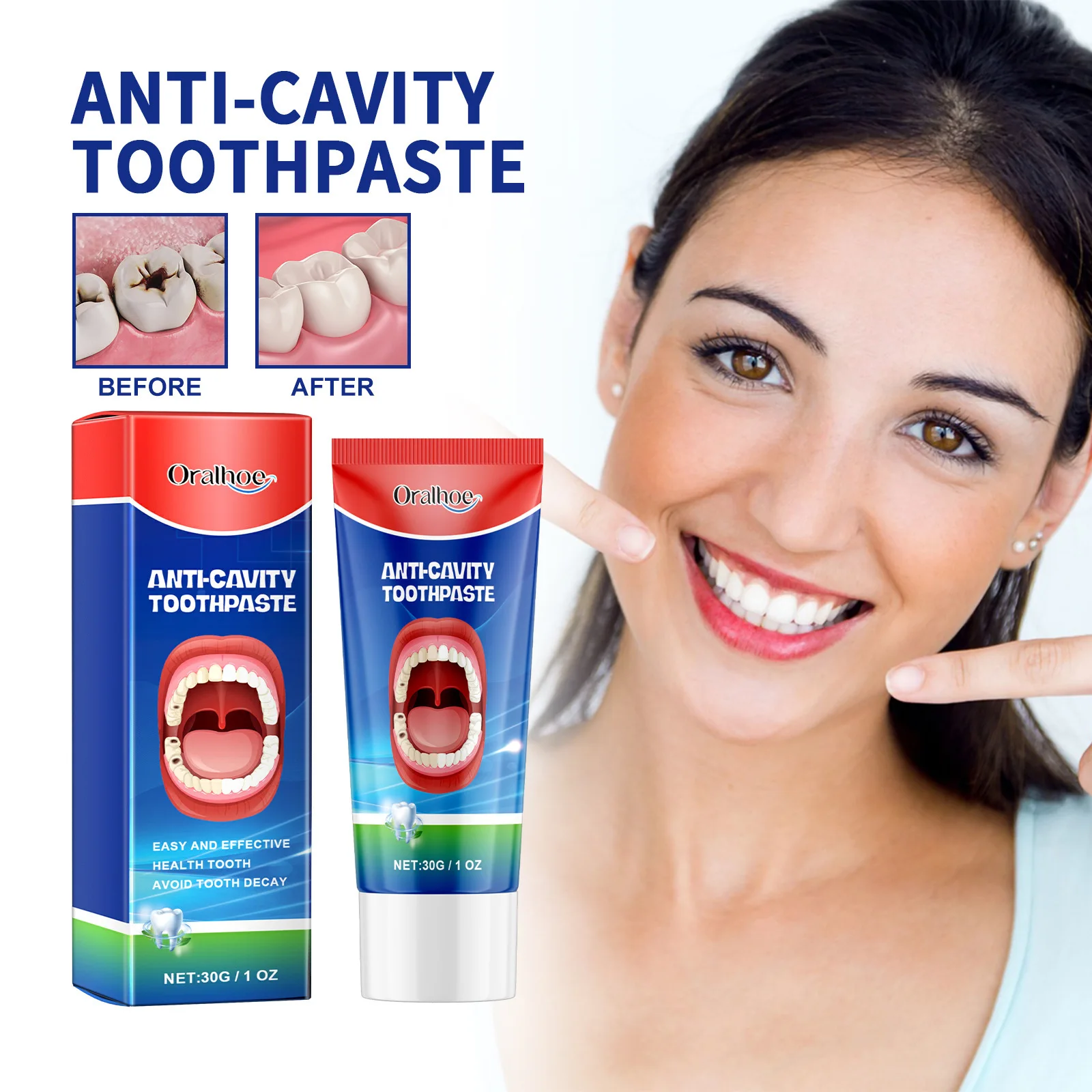 Anti Decay ยาสีฟันทันตกรรมฟันผุครีมป้องกันฟันผุป้องกันฟันลบแผ่นปวดฟันบรรเทาโรคปริทันต์อักเสบ