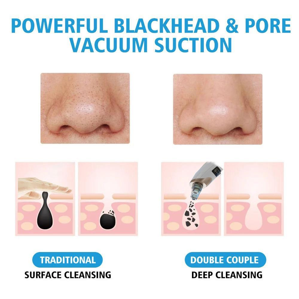 In Stock Fast Drop Shipping 3 Suction Mode Face Cleansing Beauty Machine Dead Skin Remover Face Vacuum Blackhead Removal Skin