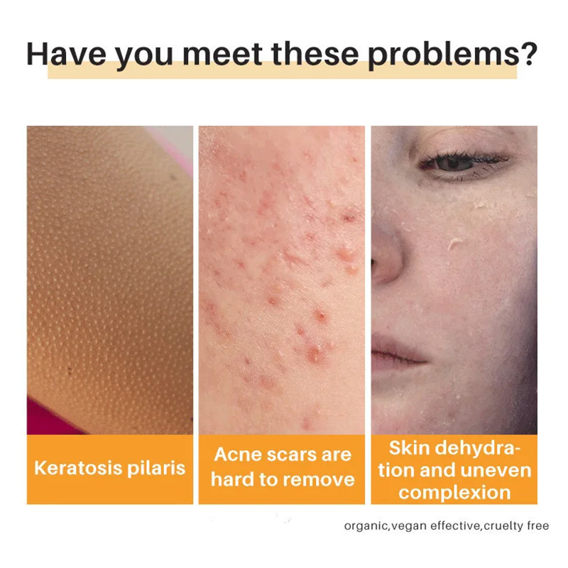 腕とあごひげのためのボディの明るい石鹸、白い香りの石鹸、深いきれいな肌、鶏の皮膚の削除、ケア製品、armpit