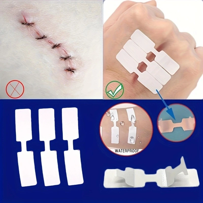 Tirita para heridas, 5 uds., cinta adhesiva para heridas al aire libre, parche desechable de primeros auxilios para sutura de heridas