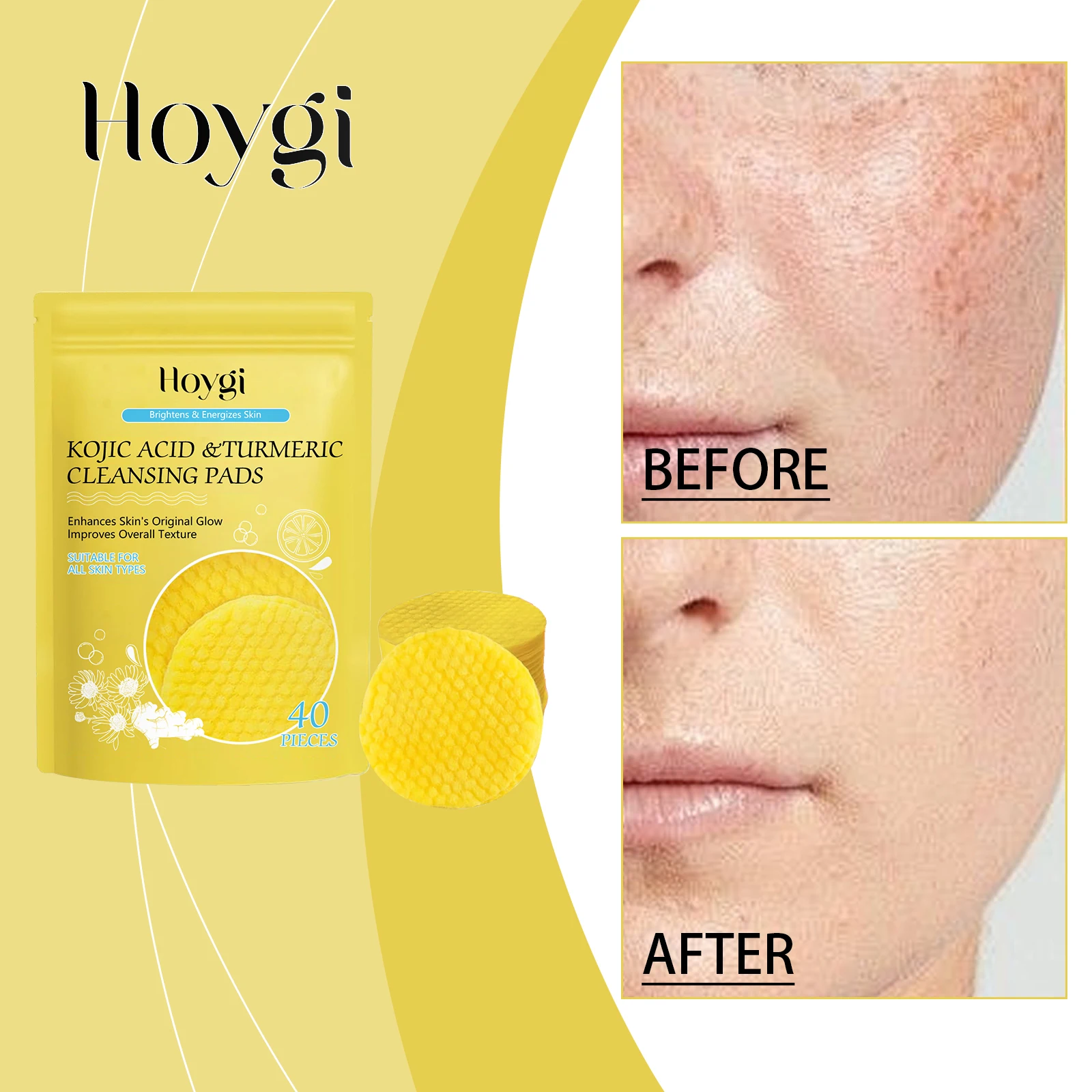 Almofadas de limpeza de ácido kójico de cúrcuma Hoygi iluminando antioxidante anti-acne esfoliação suave e controle de oleosidade todos os tipos de pele