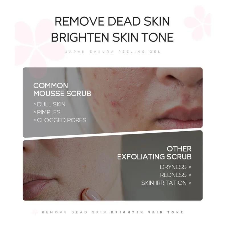 LAIKOU 桜ピーリングジェル フェイシャル角質除去 毛穴をきれいに保湿 オイルコントロール 60g