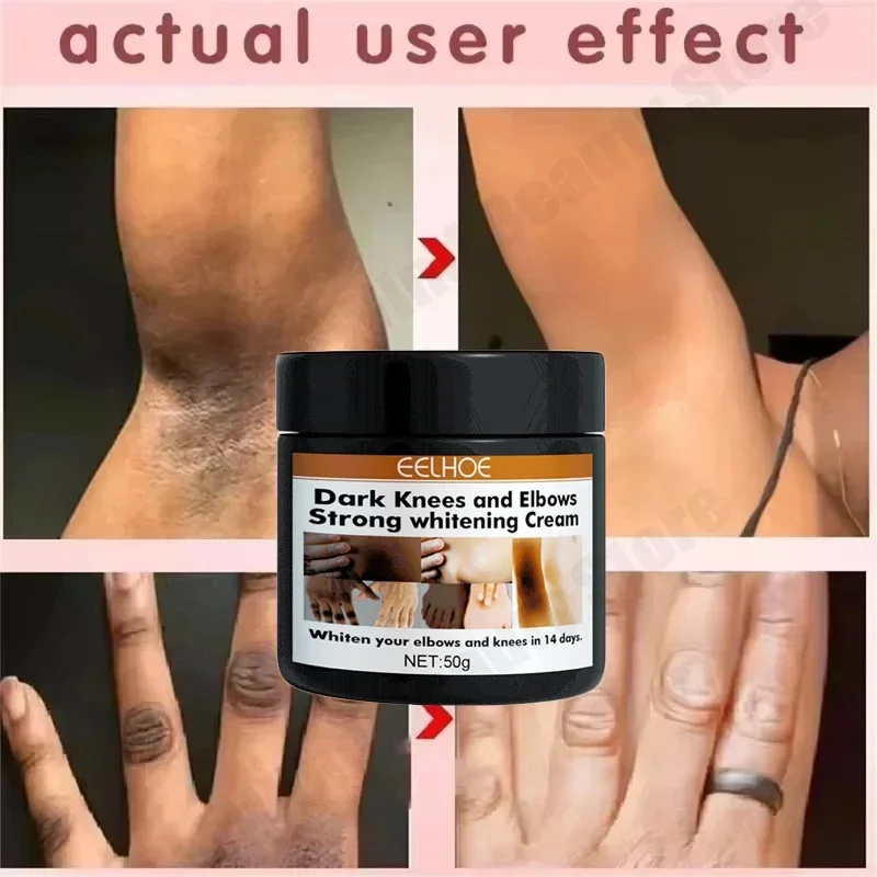 Crema para blanquear el cuerpo, partes privadas, suero blanqueador de axilas, blanqueador de glúteos, rodilla, ilumina la parte interna del muslo, íntimo, oscuro, elimina la melanina