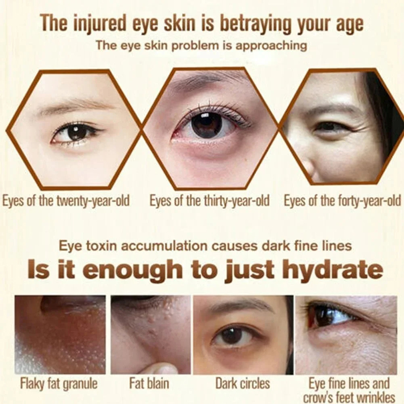 Fat Granules Remover Eye Cream Anti-Puffiness Anti Inflammatory Reduce Dark Circles Fade Fine Lines Repair Barrier Firm Cream