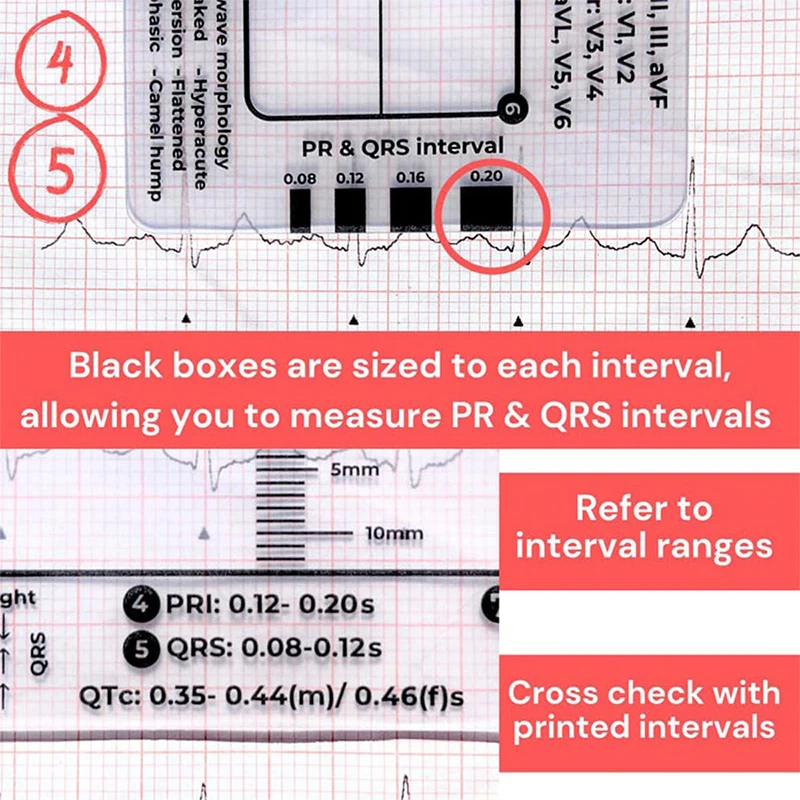 Ecg 7-step Ruler Ecg/ekg 7-step Ruler Card, Portable Pocket Ecg Ekg Caliper With Protective Sheath Evaluation Tool