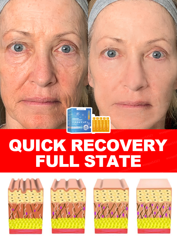 Морщины исчезают, лифтинг и затягивает, ремонт чувствительности