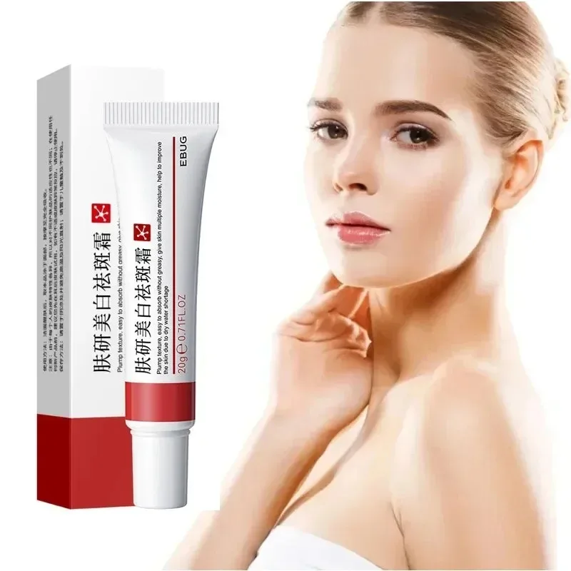 1/3/5pcs Whitening Freckle ครีม Niacinamide ลบ Dark Spot Cream Anti Freckle และ Aging ครีม Fade สีฝ้าผิว