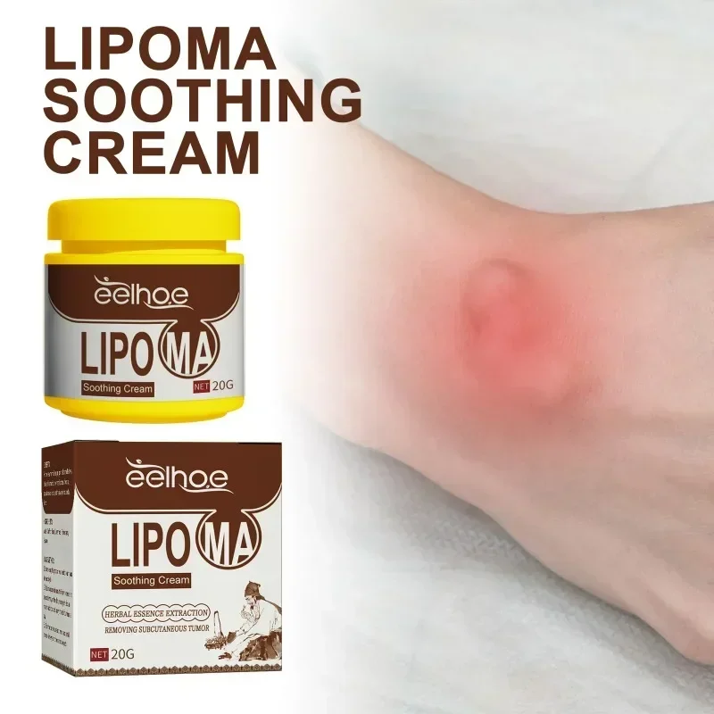 Crema calmante removedor de grumos subcutáneos