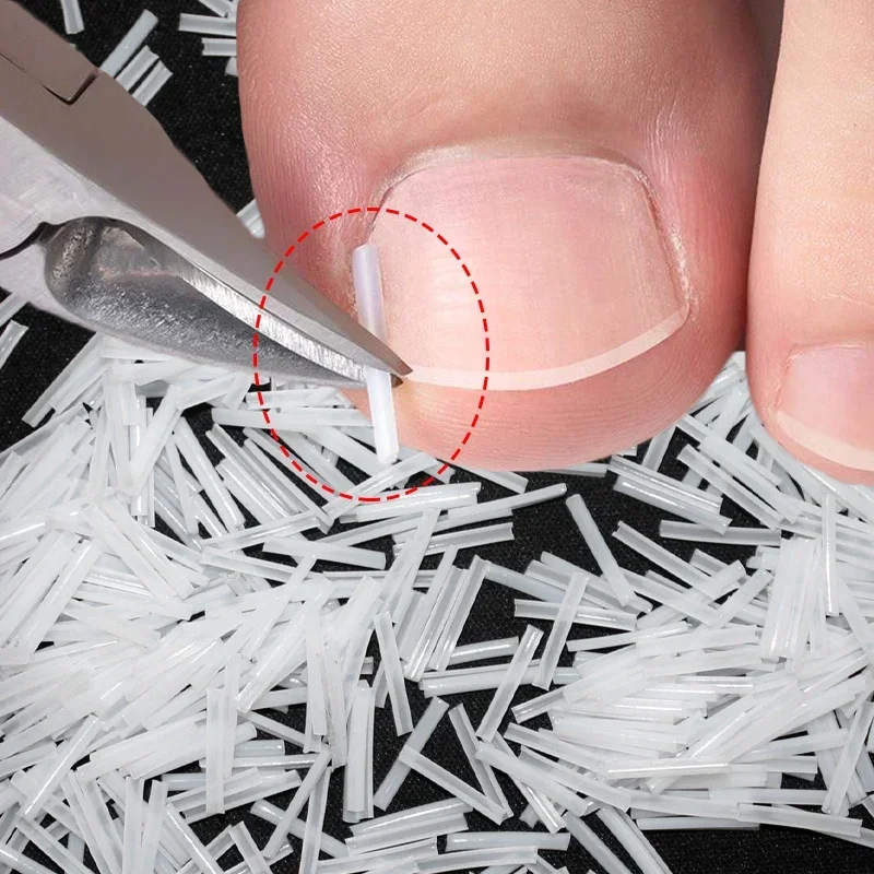 Almohadilla de tubo elástica en forma de C para uñas de los pies, Corrector de uñas encarnadas, herramientas para el cuidado de los pies, tratamiento de Clip alisador de ranura Invisible