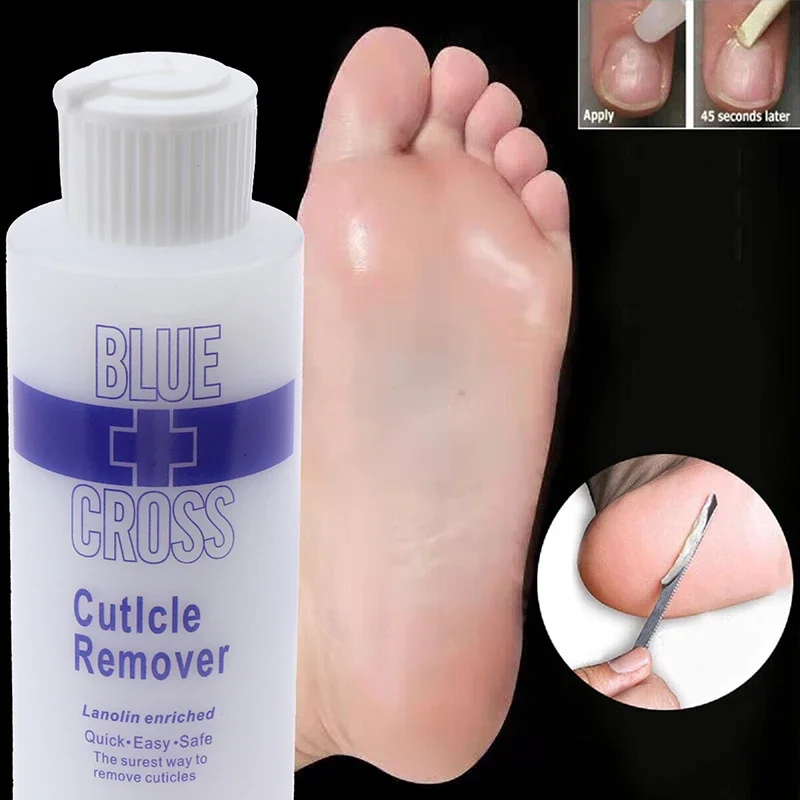 30/177ml cutícula do pé remover pé morto esfoliante amaciante remover pele morta e calosidades máscara de pé pedicure intensificador de unhas