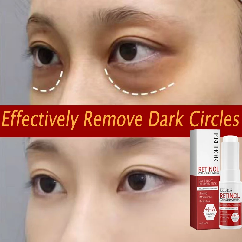 Crema para ojos con Retinol, barra multibalm de colágeno, Reduce las arrugas, bolsa para ojos, ácido hialurónico, antiojeras, hinchazón, productos para el cuidado de los ojos