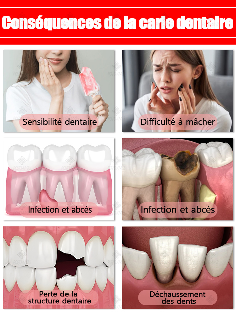 Réparer la carie dentaire, soulager la douleur des gencives, blanchiment des dents