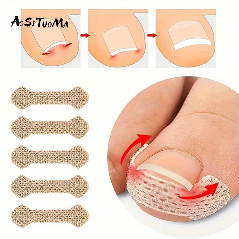 Ingrown Paronychia Toenail Corrector Tiras, Anti prego Patch, Pés dormindo prego Patch, Flesh Toe Pad Longo, 10Pcs