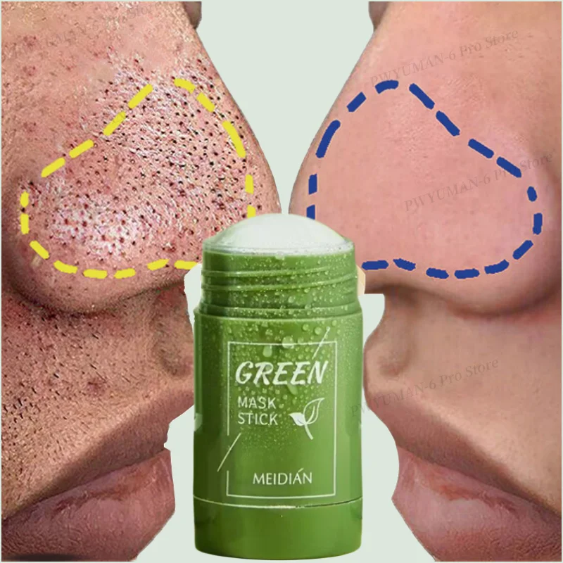 Mascarilla sólida para eliminar espinillas, 40ml, té verde, palo limpio, mascarilla Facial, disipa el acné, imperfecciones, reduce los poros, cuidado de la piel coreano, paquete múltiple