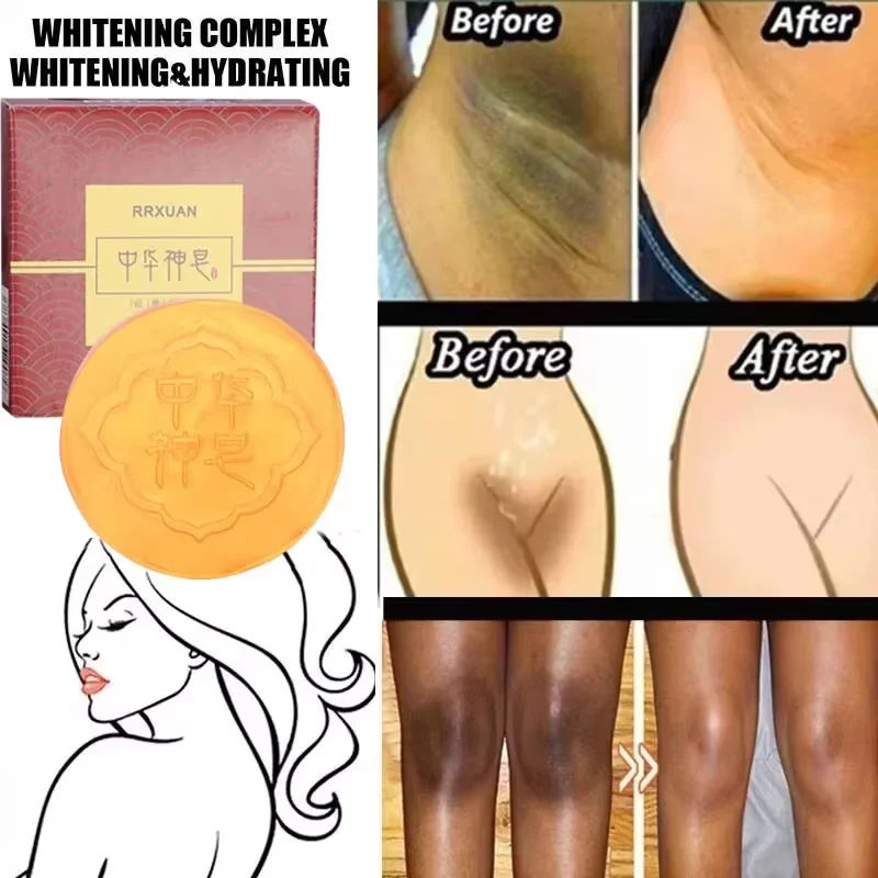 Body Whitening SOAP Deep Clean Skin สบู่กําจัดผิวไก่รักแร้ใต้วงแขนเข่า Bleaching Body Brighten White Care ผลิตภัณฑ์