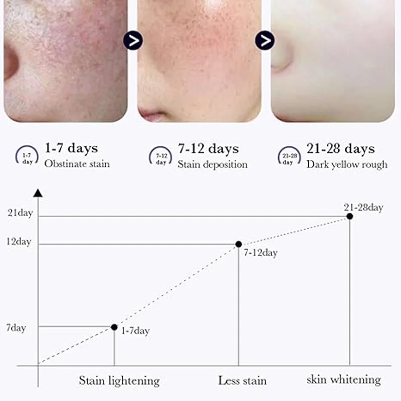 Crema correctora de manchas oscuras que reduce las manchas oscuras, el cuidado iluminador, hidrata y nutre la piel, reduce la melanina, desvanece las manchas, las pecas