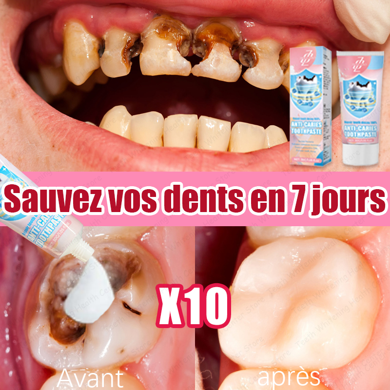 99% ᴅᴇ ᴘᴇʀsᴏɴɴᴇs ʀᴀᴄʜᴇᴛᴇ́ᴇs, ᴍᴇɪʟʟᴇᴜʀᴇs ᴠᴇɴᴛᴇs ᴘᴏᴜʀ ʟᴀ ʀᴇ́ᴘᴀʀᴀᴛɪᴏɴ ᴅᴇ ʟᴀ ᴄᴀʀɪᴇ ᴅᴇɴᴛᴀɪʀᴇ