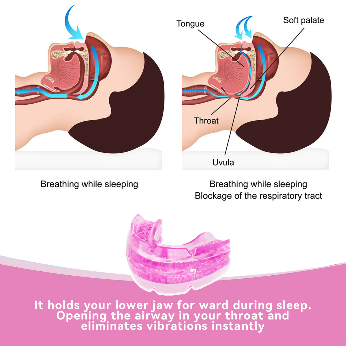 Anti-Snoring Device Anti Snoring Mouthpiece Mouth Guard for Women Men Snore Reducing Most Comfortable Adjustable Oral Appliance