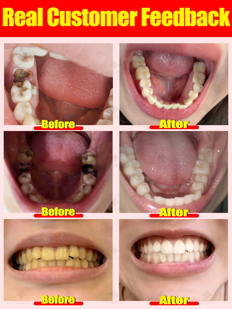 Herstelt gaatjes, verhelpt kiespijn, herstelt en bleekt tanden.