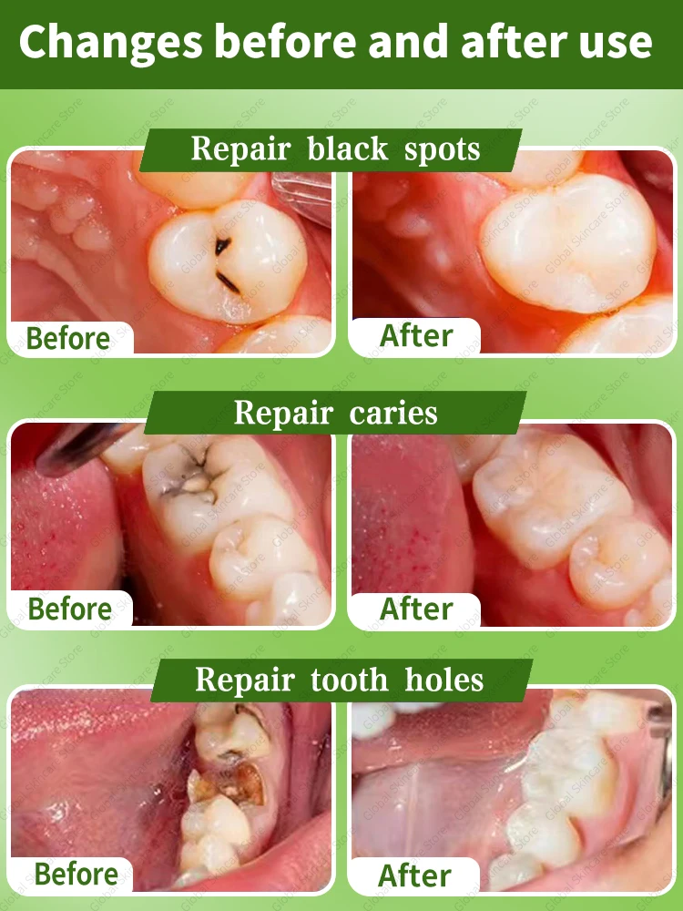Solve all dental problems