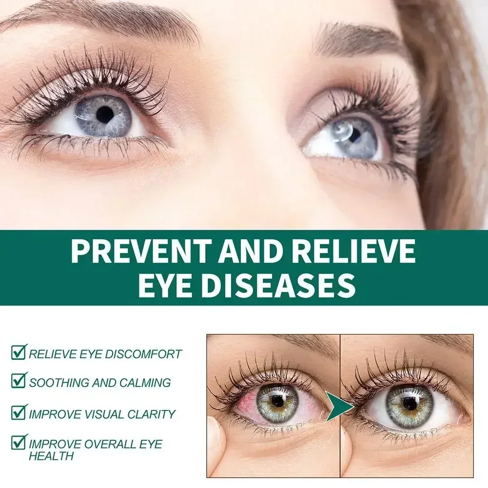 Gotas para los ojos alivia el molestio de los ojos ojos borrosos cuidado de los ojos doloroso picazón relaja la hinchazón seca masaje limpio