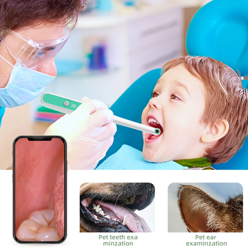 Telecamera per visita visiva della bocca WIFI portatile Cura dei denti wireless Ispezione endoscopio impermeabile IP67 per telefono Android IOS