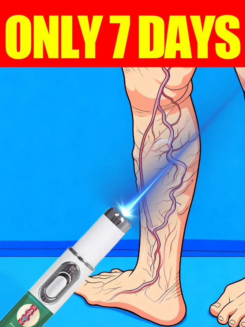 Laser vein pen Remove varicose veins from the body
