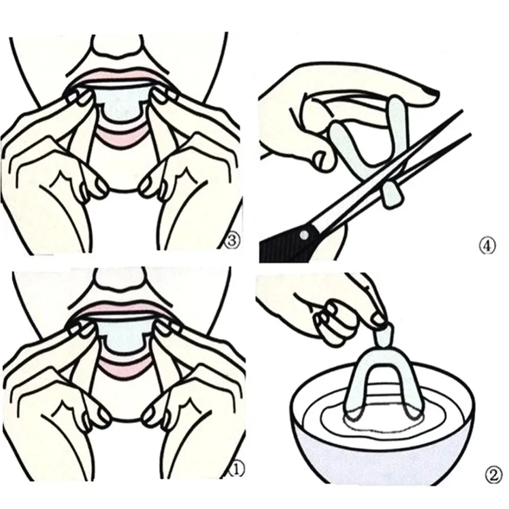 Protector bucal nocturno de silicona para apretar los dientes, ayuda para dormir, bandeja bucal para blanquear los dientes, bandeja Dental formada con calefacción DIY