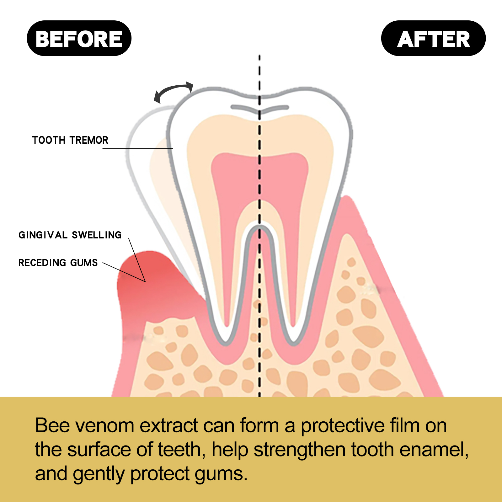 Gum Repair Toothpaste Plaque Caries Removal Protect Gingiva Treat Bad Breath Fade Tooth Stain Deep Clean Brightening Toothpaste