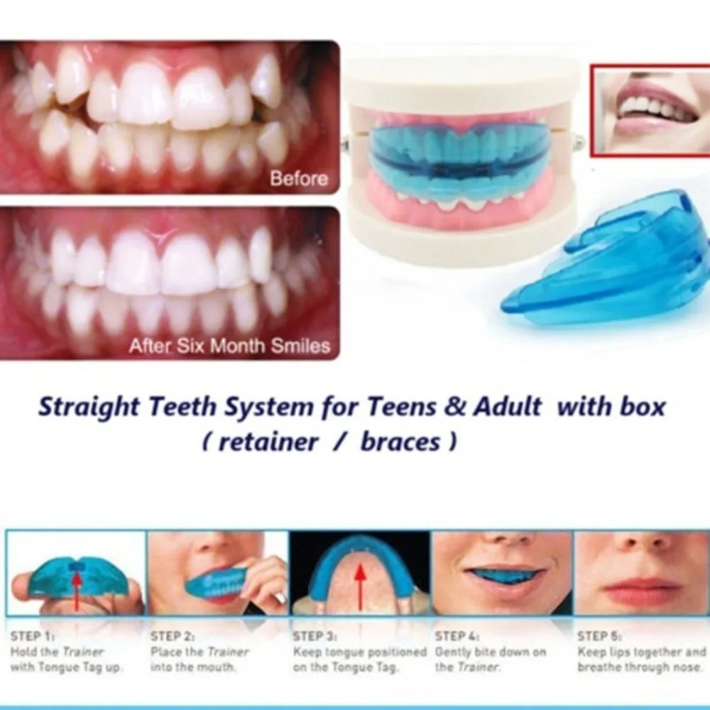 Aparatos dentales de ortodoncia, aparato de alineación de silicona, retenedor de dientes, protector de bruxismo, retenedor de dientes, 1 ud.