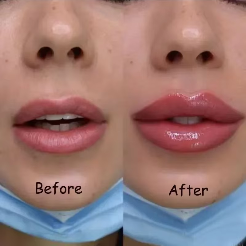 Aceite voluminizador instantáneo para labios, potenciador de labios, brillo de labios, suero hidratante, lápiz labial antiarrugas, maquillaje Sexy para el cuidado de los labios