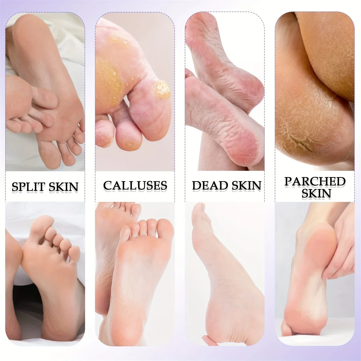 8/10 pçs conjunto de pedicure peeling e esfoliante calos pé esfregando escova de aço inoxidável dupla face cuidados com os pés pedal pedra